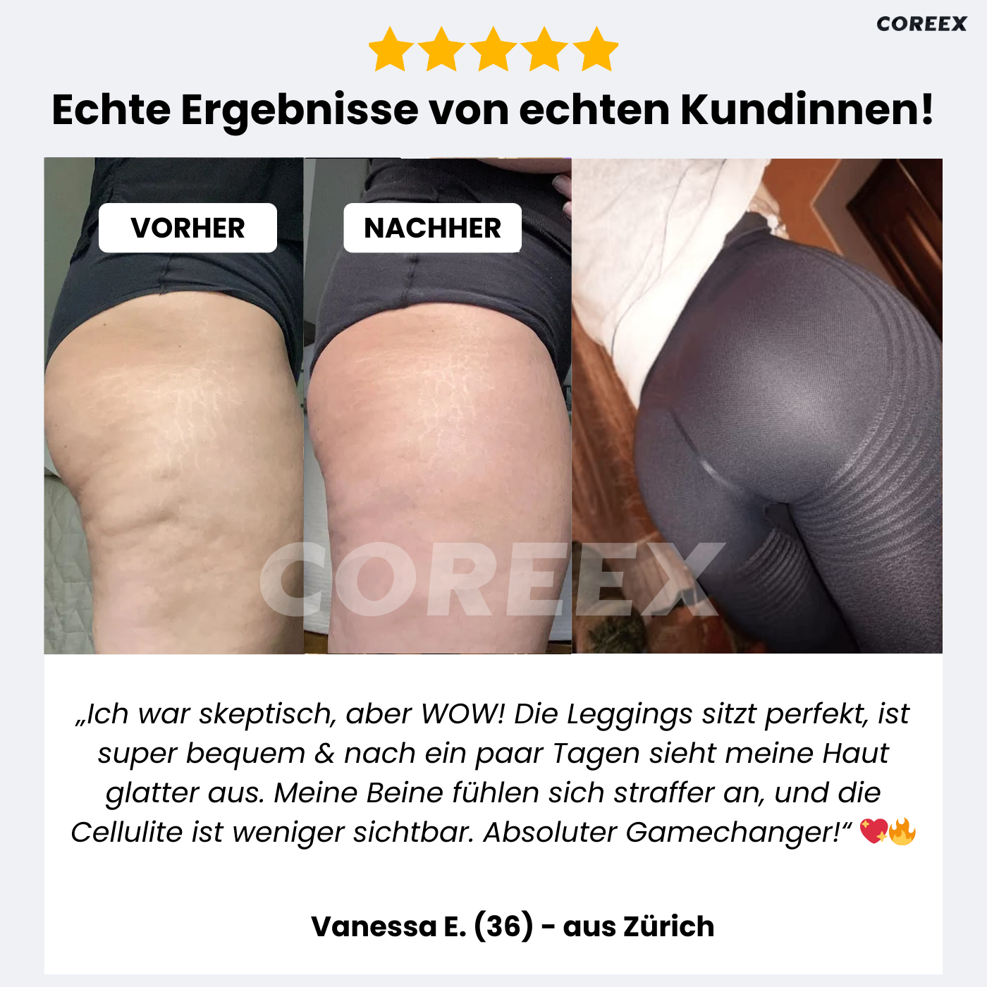 COREEX CelluFlex™ 3D-Kompressionsleggings