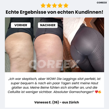 COREEX CelluFlex™ 3D-Kompressionsleggings