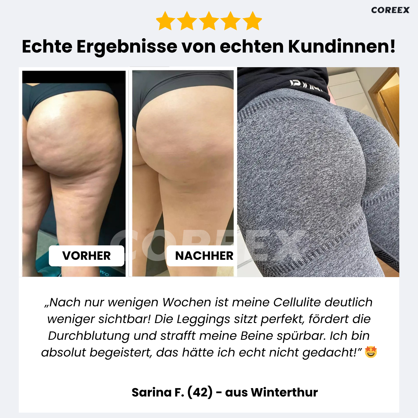COREEX CelluFlex™ 3D-Kompressionsleggings