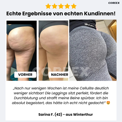 COREEX CelluFlex™ 3D-Kompressionsleggings