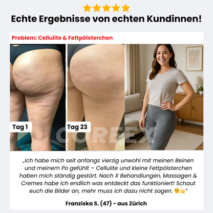 COREEX CelluFlex™ 3D-Kompressionsleggings